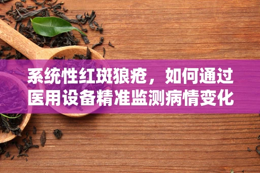 系统性红斑狼疮，如何通过医用设备精准监测病情变化？