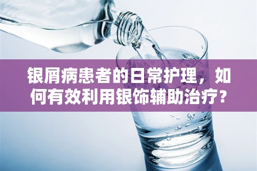 银屑病患者的日常护理，如何有效利用银饰辅助治疗？